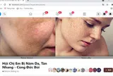 Hội nhóm chia sẻ bí kíp mờ nám, tàn nhang: trào lưu làm đẹp thời 4.0