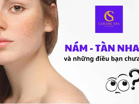 Nám, tàn nhang và những điều bạn chưa biết