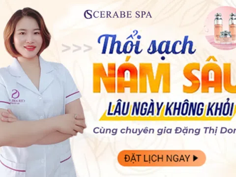 Cerabe Spa cơ sở 29 thực hiện điều trị nám chuẩn y khoa bởi chuyên gia Đăng Dong